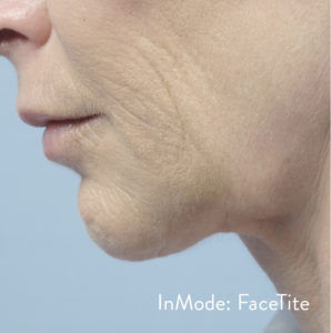 RGV Cosmetic Surgery Vein Care 