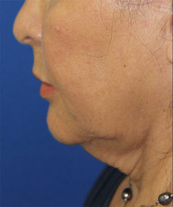 RGV Cosmetic Surgery Vein Care 