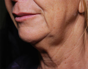 RGV Cosmetic Surgery Vein Care 