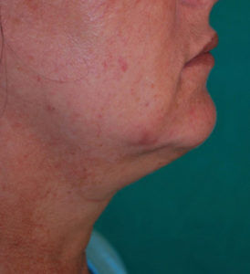 RGV Cosmetic Surgery Vein Care 