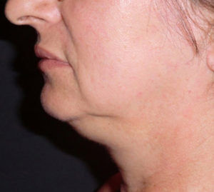 RGV Cosmetic Surgery Vein Care 