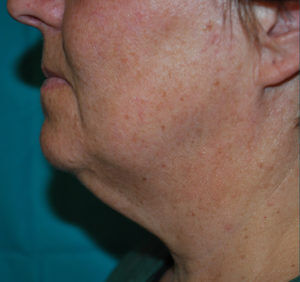 RGV Cosmetic Surgery Vein Care 