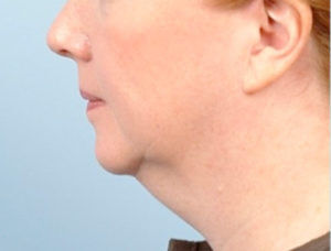 RGV Cosmetic Surgery Vein Care 