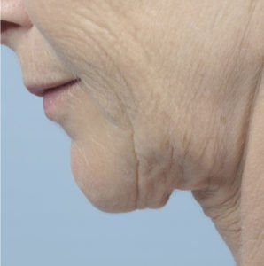RGV Cosmetic Surgery Vein Care 