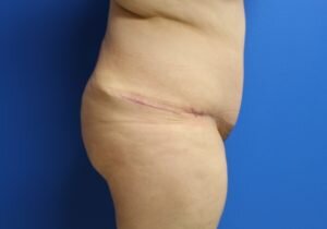 RGV Cosmetic Surgery Vein Care 