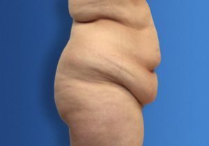 RGV Cosmetic Surgery Vein Care 