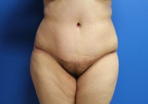 RGV Cosmetic Surgery Vein Care 