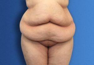 RGV Cosmetic Surgery Vein Care 