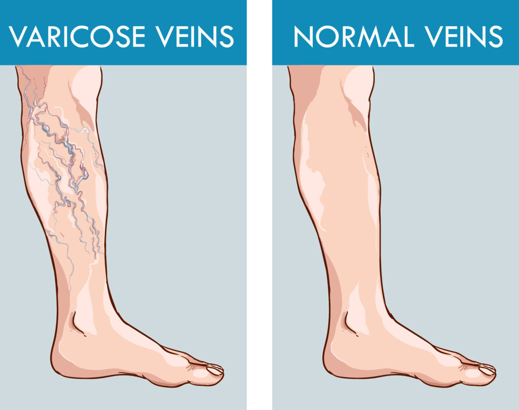 RGV Cosmetic Surgery Vein Care 