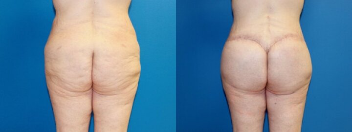 RGV Cosmetic Surgery Vein Care RGV Cosmetic Surgery Vein Care