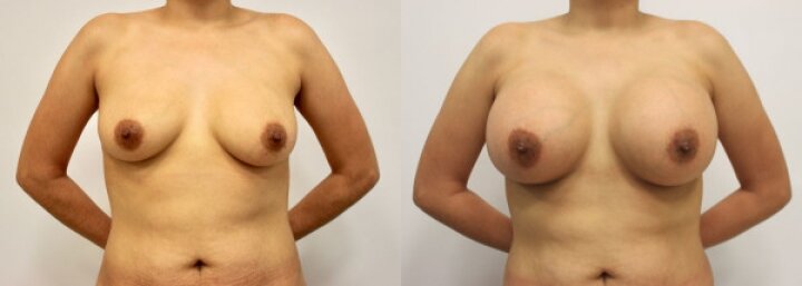 RGV Cosmetic Surgery Vein Care RGV Cosmetic Surgery Vein Care