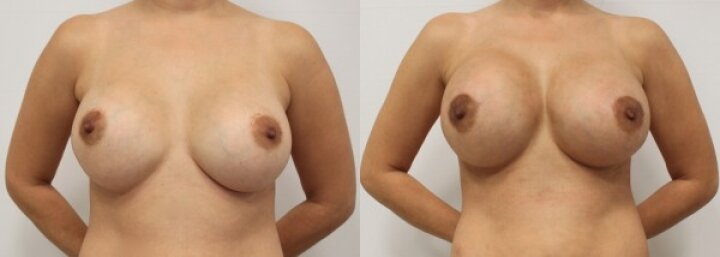 RGV Cosmetic Surgery Vein Care RGV Cosmetic Surgery Vein Care