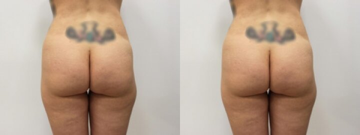 RGV Cosmetic Surgery Vein Care RGV Cosmetic Surgery Vein Care