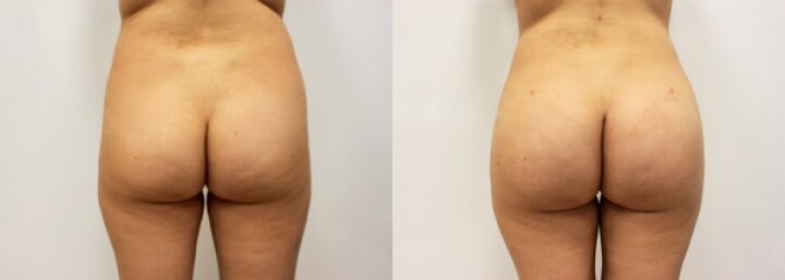 RGV Cosmetic Surgery Vein Care RGV Cosmetic Surgery Vein Care