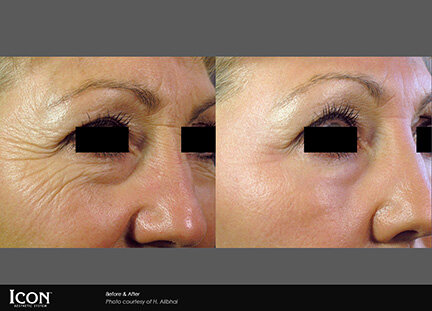 RGV Cosmetic Surgery Vein Care RGV Cosmetic Surgery Vein Care