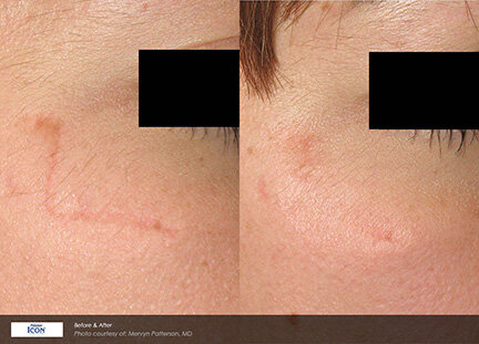 RGV Cosmetic Surgery Vein Care RGV Cosmetic Surgery Vein Care