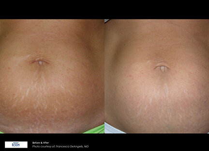 RGV Cosmetic Surgery Vein Care RGV Cosmetic Surgery Vein Care