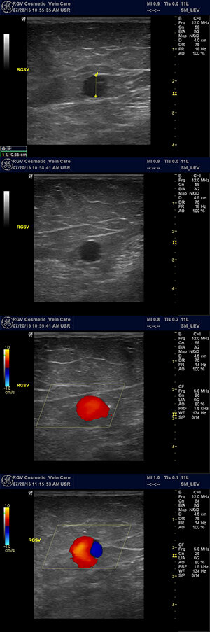 RGV Cosmetic Surgery Vein Care RGV Cosmetic Surgery Vein Care