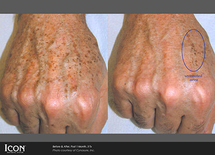 RGV Cosmetic Surgery Vein Care RGV Cosmetic Surgery Vein Care