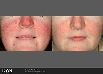 RGV Cosmetic Surgery Vein Care RGV Cosmetic Surgery Vein Care