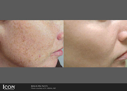 RGV Cosmetic Surgery Vein Care RGV Cosmetic Surgery Vein Care
