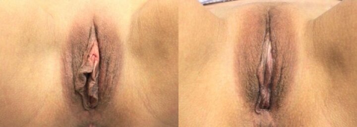 RGV Cosmetic Surgery Vein Care RGV Cosmetic Surgery Vein Care