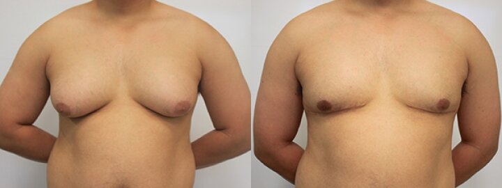 RGV Cosmetic Surgery Vein Care RGV Cosmetic Surgery Vein Care