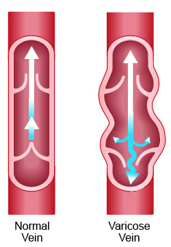 RGV Cosmetic Surgery Vein Care RGV Cosmetic Surgery Vein Care