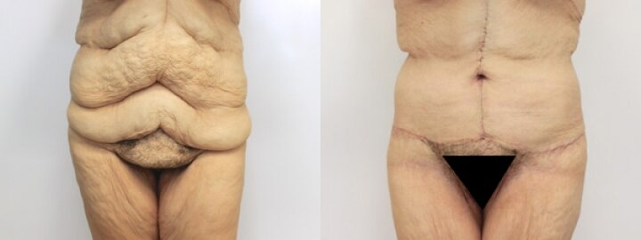RGV Cosmetic Surgery Vein Care RGV Cosmetic Surgery Vein Care