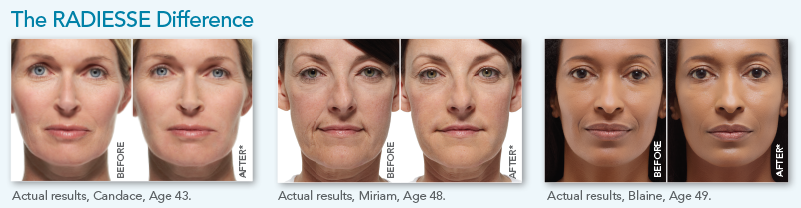 RGV Cosmetic Surgery Vein Care 