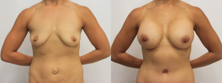 RGV Cosmetic Surgery Vein Care RGV Cosmetic Surgery Vein Care