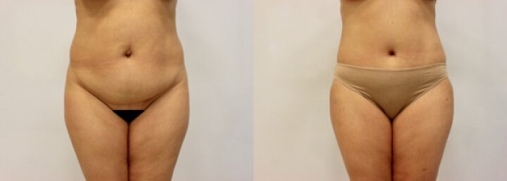 RGV Cosmetic Surgery Vein Care RGV Cosmetic Surgery Vein Care