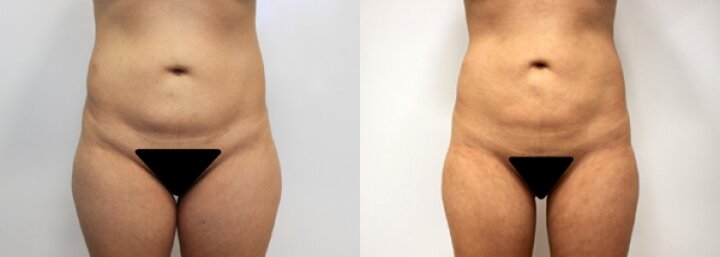 RGV Cosmetic Surgery Vein Care RGV Cosmetic Surgery Vein Care